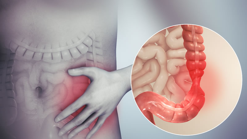 position of bowel digestive concerns